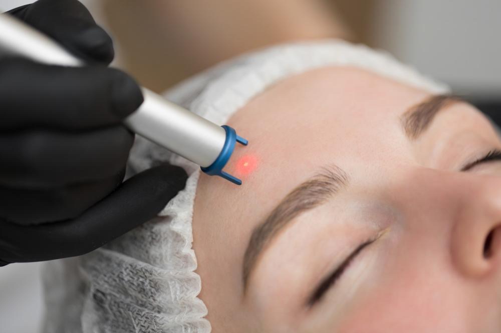 séance de luxopuncture sur visage